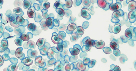 Stem cells and insomnia? Are we there yet?